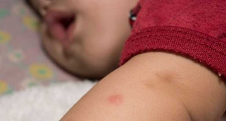 Bebê é primeira vítima de dengue em MS este ano