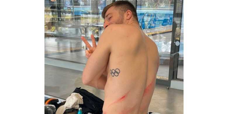 Saltador franc&ecirc;s se machuca em apresenta&ccedil;&atilde;o