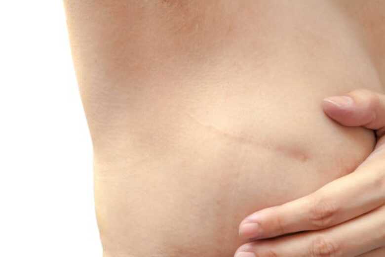 Foto: iStock