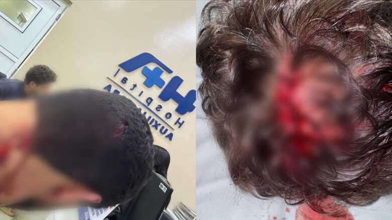 Jovens tiveram ferimentos e procuraram unidade hospitalar para atendimento