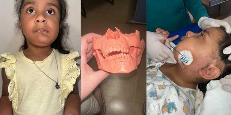 Menina passou por procedimento inovador