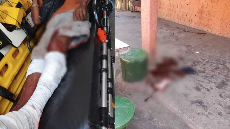 Vítima foi encaminhada para a unidade hospitalar