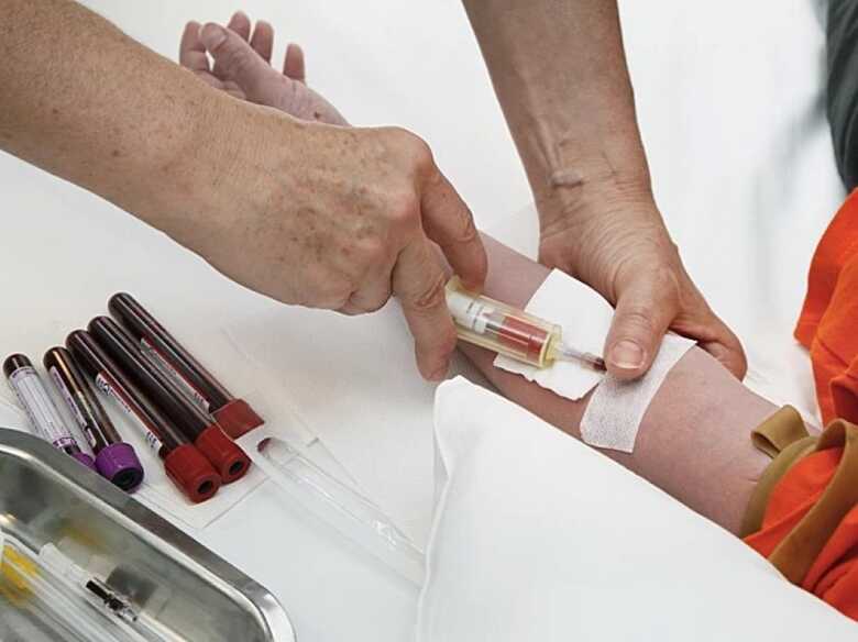 O Ministério da Saúde terá 30 dias para instituir um grupo de trabalho temporário encarregado de propor normas complementares 