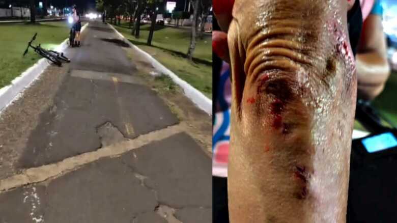 Ciclovia esburacada trouxe prejuízos para uma ciclista