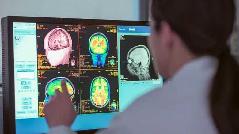 Cientistas fizeram novos estudos com o cérebro humano