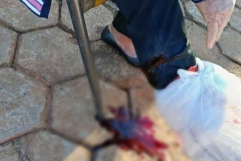 Idosa foi atacada na perna direita