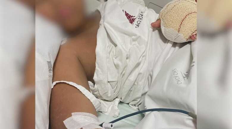 O menino, de 9 anos, teve seus dedos decepados após sofrer um episódio de violência em uma escola em Portugal