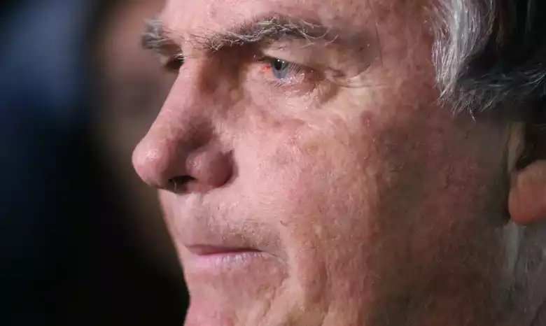 Este &eacute; o terceiro procedimento cir&uacute;rgico de Bolsonaro para bloquear o nervo fr&ecirc;nico e tentar conter as crises de solu&ccedil;os