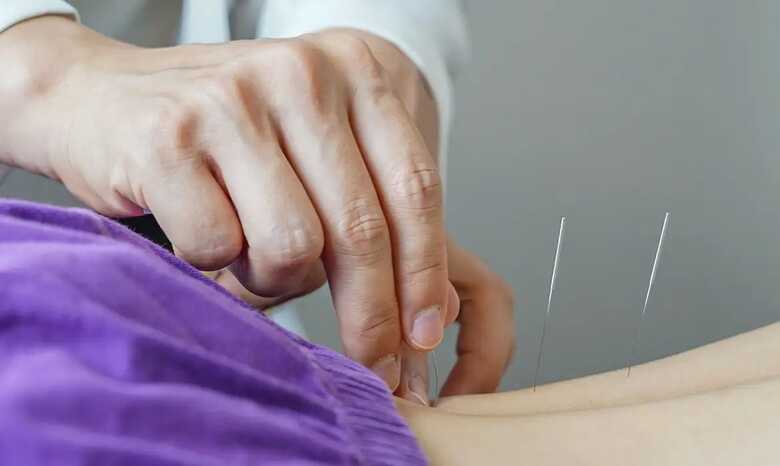 A profiss&atilde;o de acupunturista est&aacute; regulamentada no Brasil