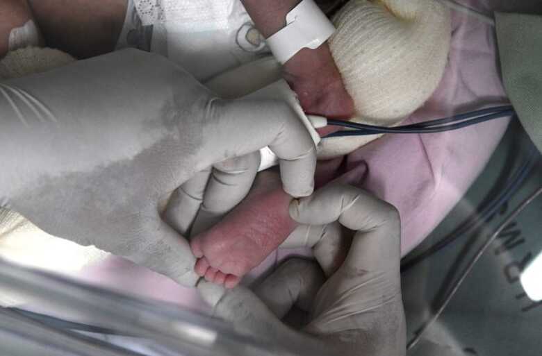 A amplia&ccedil;&atilde;o contempla beb&ecirc;s nascidos com menos de 37 semanas de gesta&ccedil;&atilde;o (36 semanas e 6 dias) ou com peso inferior a 1.500 gramas