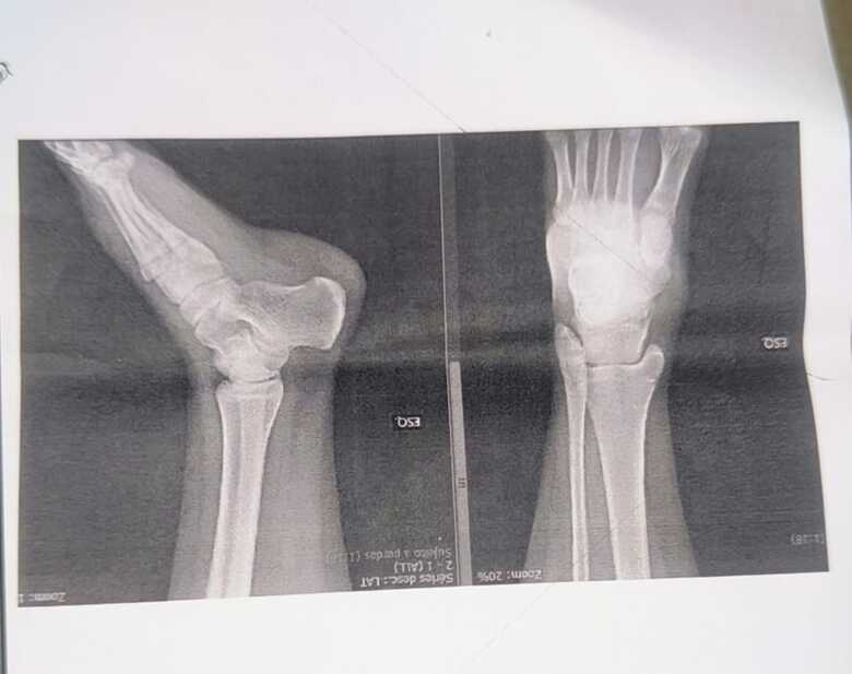 Foto: Reprodu&ccedil;&atilde;o