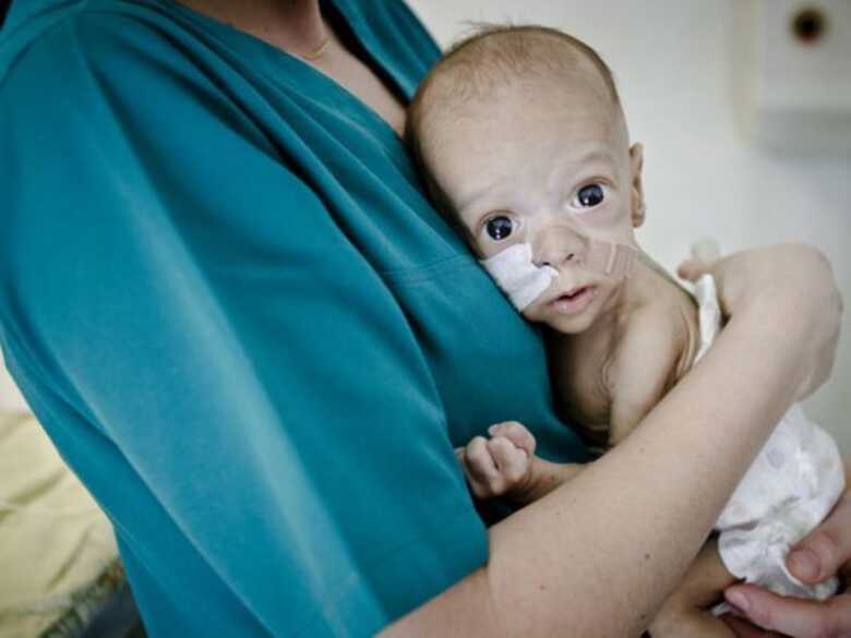 Bebê Andrei nasceu sem intestinos e espera por operação. Foto foi tirada em 27 de março.