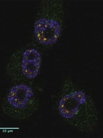Manchas em verde na imagem mostram presença da proteína CPEB1 em quatro células cancerígenas.