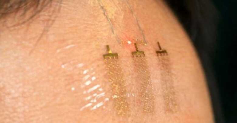 Adesivo ultrafino e flex&iacute;vel colocado na testa pode monitorar a atividade cerebral de pacientes, mostra pesquisa.