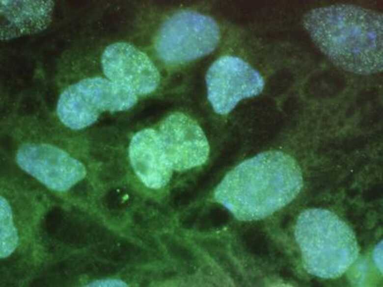 Células-tronco são vistas em tela de computador. (Foto: Getty Images)