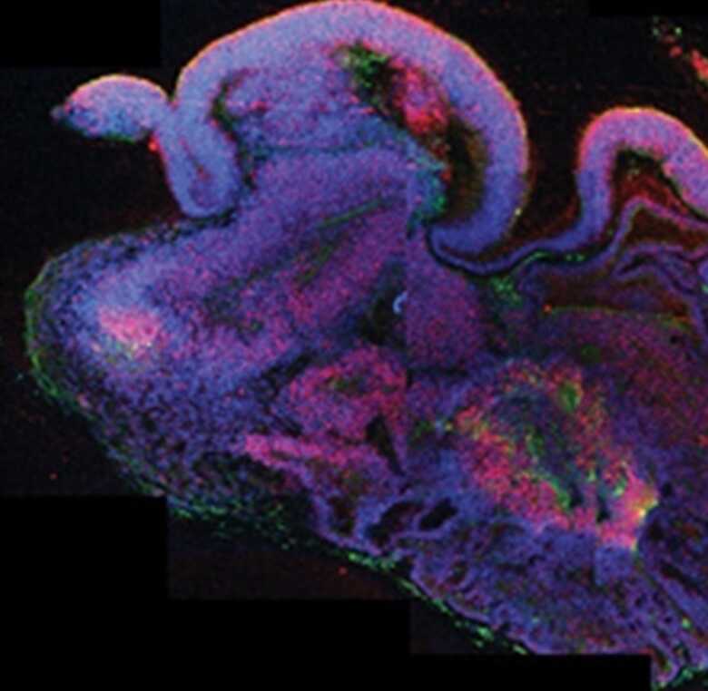 Grupo do Instituto de Biotecnologia Molecular da Academia de Ciências Austríaca criou um cérebro a partir de células-tronco embrionárias e de pele adulta. (Foto: Nature)