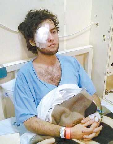 O estudante Vitor Araújo, internado no Hospital das Clínicas. (Foto: reprodução/Folha/Grupo de Apoio ao Protesto Popular)