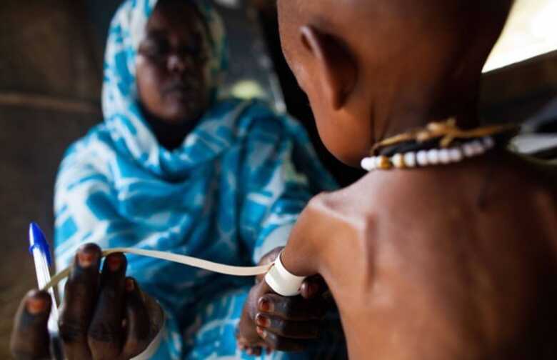 Enfermeira mede braço de criança que sofre de desnutrição, no campo de Abu Shouk, no Sudão, nessa segunda-feira (30). (Foto: AP)
