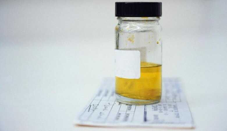 Teste vai detectar câncer de próstata em amostra simples de urina. (Foto: divulgação)