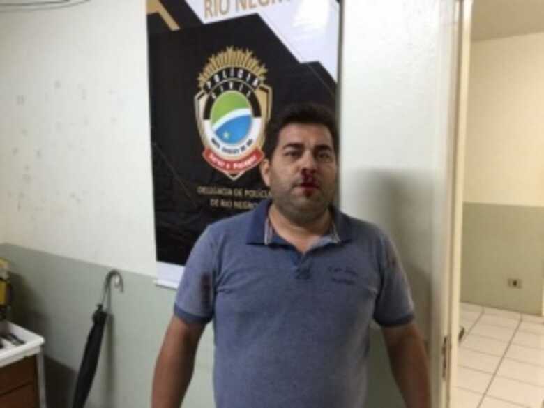 Ex-secretário agredido por filho de prefeito foi à delegacia prestar queixa