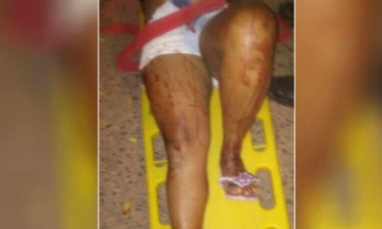 Mulher golpeada várias vezes foi socorrida pelos bombeiros