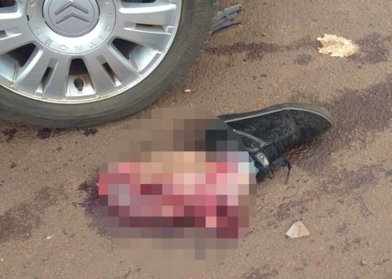 O motocilista  teve a perna decepada na colis&atilde;o com um Citroen C#