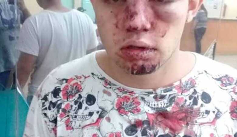 Jovem ficou com o rosto todo ensanguentado após a agressão e foi orientado a procurar atendimento médico