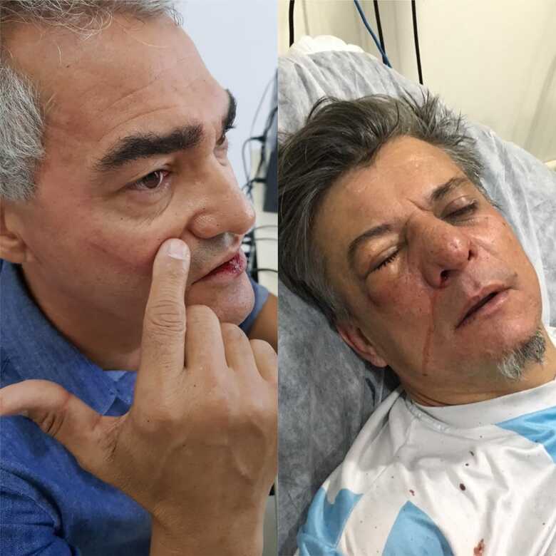 Vereador Amauri Cardoso (PSDB) e deputado federal Boca Aberta (PROS) brigam no Centro de Londrina