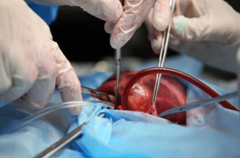 O Hospital da Cassems está autorizado para realizar transplantes de coração
