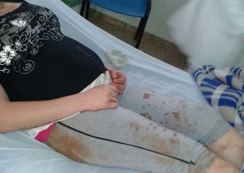 Joice Bernadete Feitosa foi agredida com chutes e socos pelo jovem