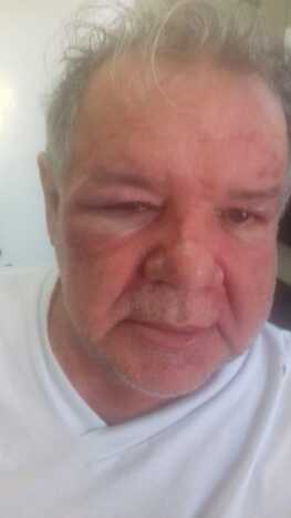 Homem de 61 anos foi atingido com spray de pimenta e levou socos e chutes