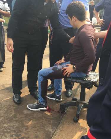 Imagens que estão circulando pelas redes sociais mostram jovem com marca de sangue na perna esquerda