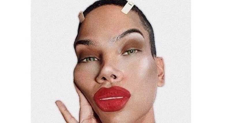 Filtro do Instagram simula os resultados de uma cirurgia pl&aacute;stica