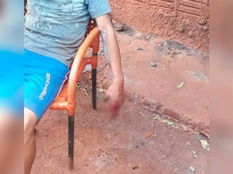 Garoto com m&atilde;o machucada