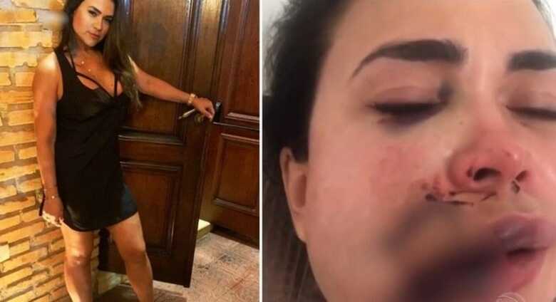 Corretora de imóveis relata ter sido agredida em restaurante no Jockey Club de SP