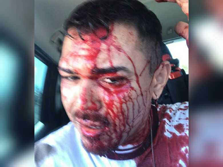 Edu Alves após agressão