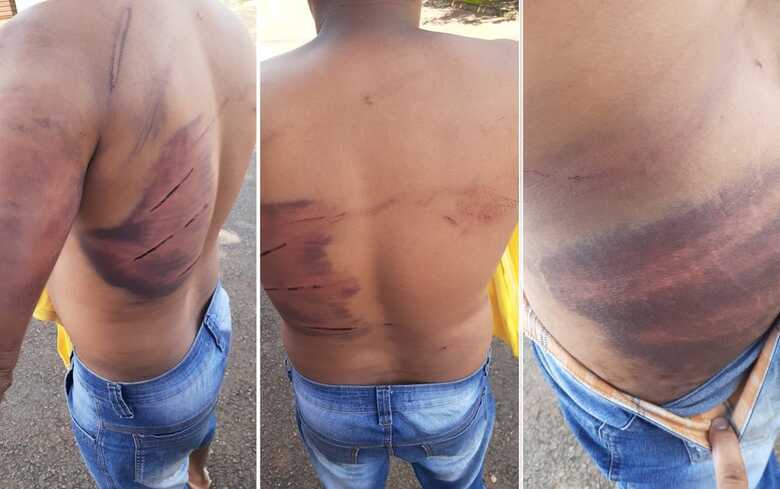 A vítima foi agredida com tapas e chicoteada com corda e mangueira