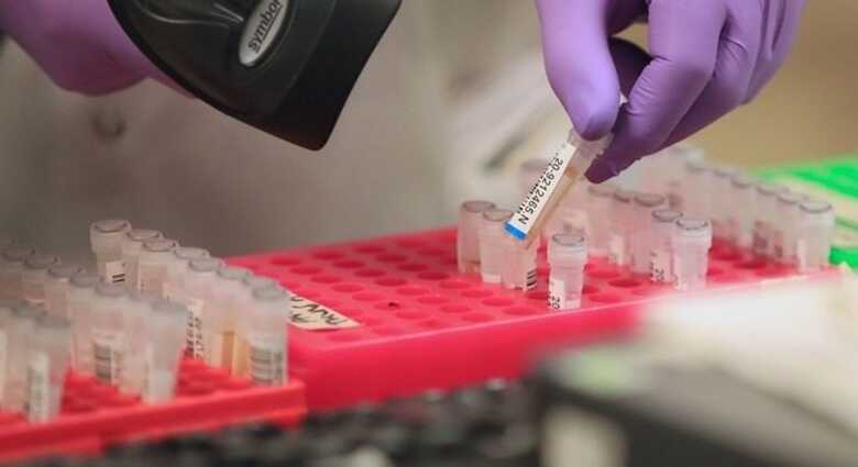 Ministério da Saúde enviou para o Estado outros 120 testes, além dos 240 destinados anteriormente.