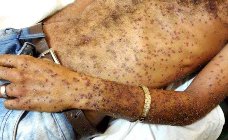 O caso foi registrado na 1ª Delegacia de Polícia Civil do Município