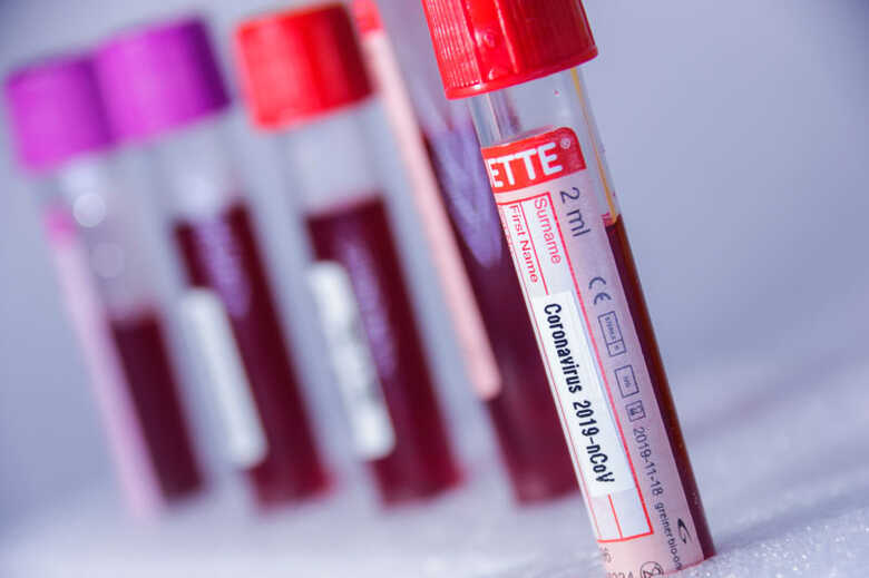 Pacientes s&atilde;o curados do coronav&iacute;rus ap&oacute;s o uso de cloroquina