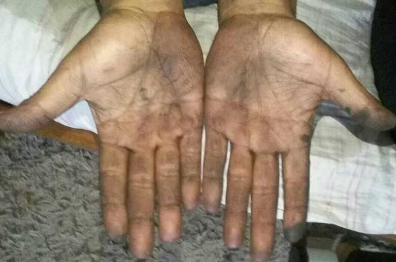 Homem estava com as mãos sujas de graxa, que é um composto de óleos lubrificantes que não saem facilmente
