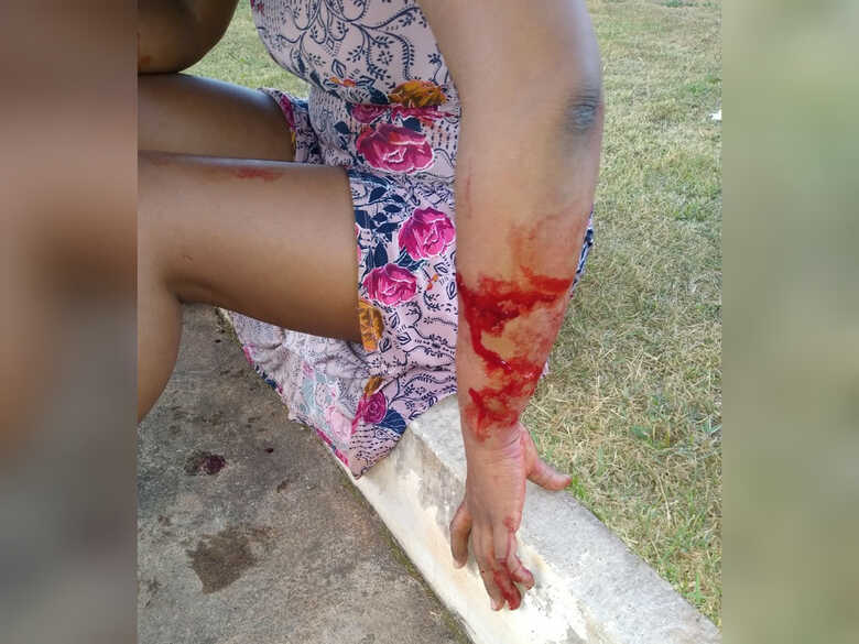 Vítima ficou com o braço e as pernas machucadas e precisou de suturas