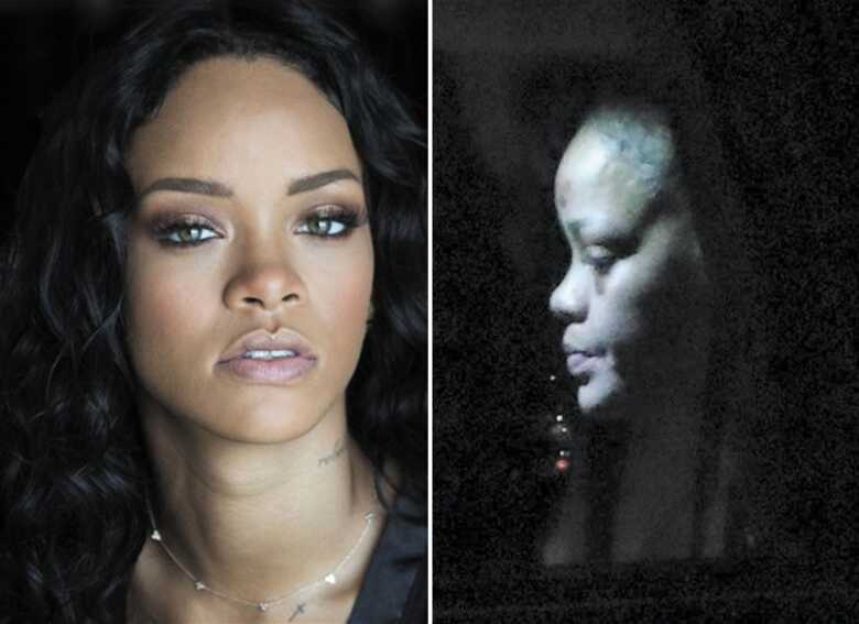 Ela estava com marcas roxas na teste e embaixo dos olhos