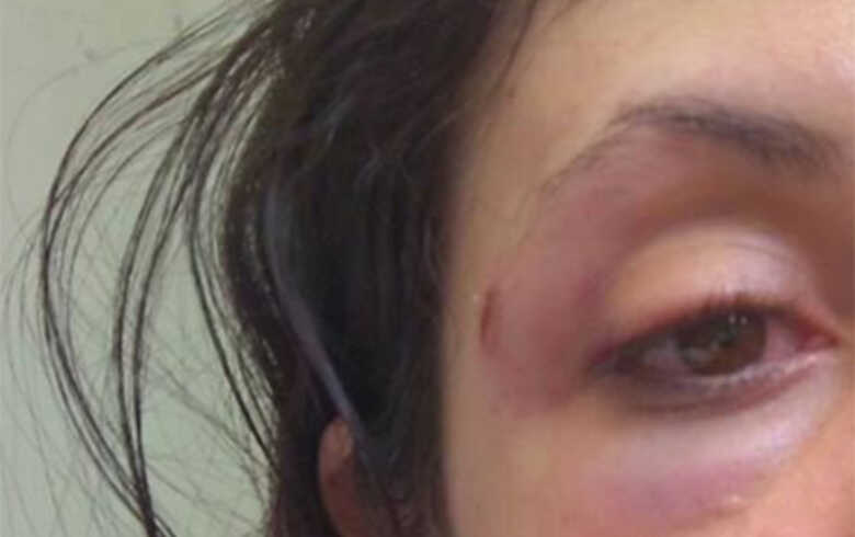 A mulher conseguiu fugir e pedir socorro para a pol&iacute;cia. O homem n&atilde;o foi encontrado