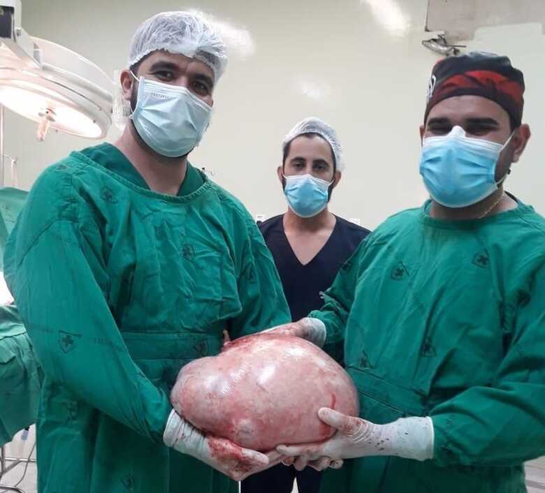Tumor de quase 20 quilos &eacute; retirado do ov&aacute;rio de paciente em Cruzeiro do Sul