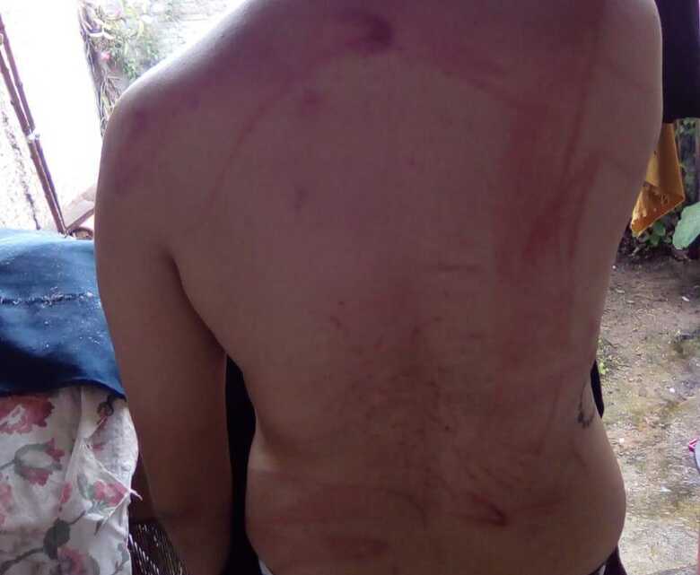 Adolescente de 16 anos foi espancada pelo pai por ser l&eacute;sbica, na Bahia