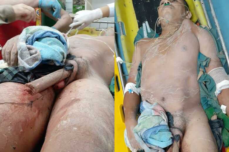 Nas imagens &eacute; poss&iacute;vel observar que as roupas do rapaz transpassaram seu &oacute;rg&atilde;o genital