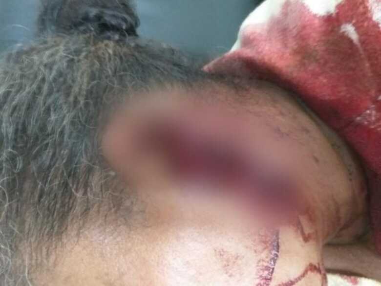 Homem bateu com o facão na orelha da vítima e acabou cortando parte do seu cabelo
